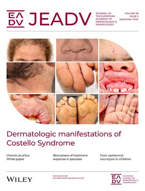 Differential Diagnosis Of Contact Dermatitis A Practical‐approach Review By The Eadv Task Force