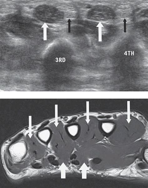 S Ss U S C Uzr On Twitter Imaging Of The Hand Free Pdf