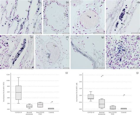 Immunostaining For Citrullinated Histone H3 CitH3 Dark Blue