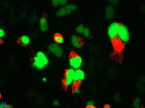 Time Lapse Imaging Of Dividing HeLa Cells YouTube