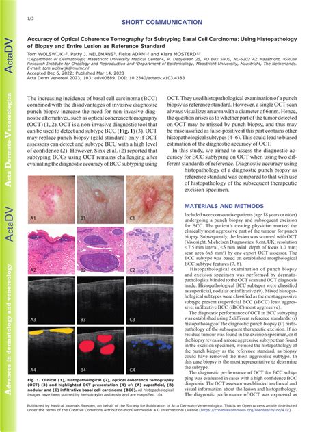 Pdf Accuracy Of Optical Coherence Tomography For Subtyping Basal Cell