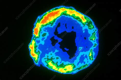 Tycho's Supernova - Stock Image - C004/9227 - Science Photo Library
