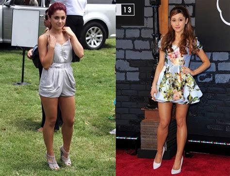 Ariana Grande Before And After Plastic Surgery