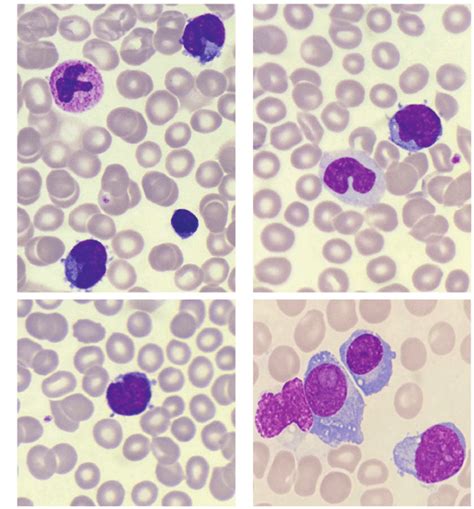 Wright S Stain Preparation Principle Procedure And Off