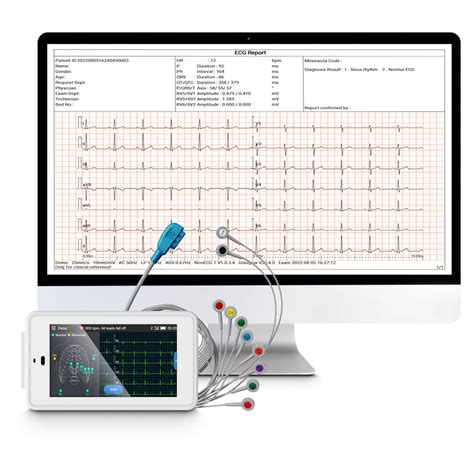 Mobile 6/12-Lead EKG/ECG Machine Fits into Your Pocket, with Auto Interpretation, Wirelessly ...