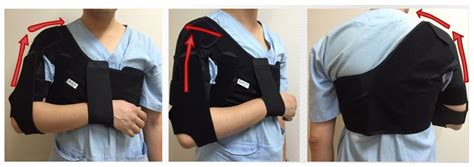 IJERPH Free Full Text Elastic Dynamic Sling On Subluxation Of