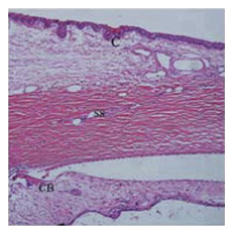 Histological Features Of Filtering Positions After Days