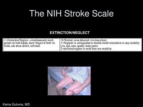 Ppt Stroke Systems And Stroke Scales In The Management Of Acute