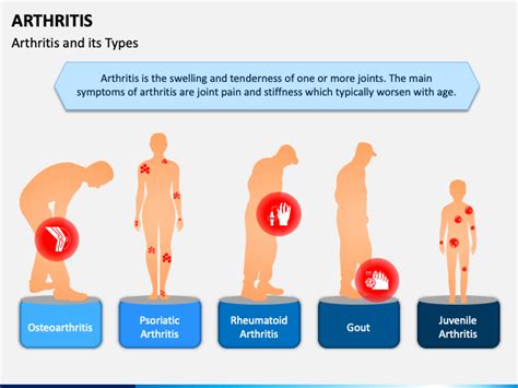 What Are The Types Of Arthritis Buying Discounted | www.bharatagritech.com