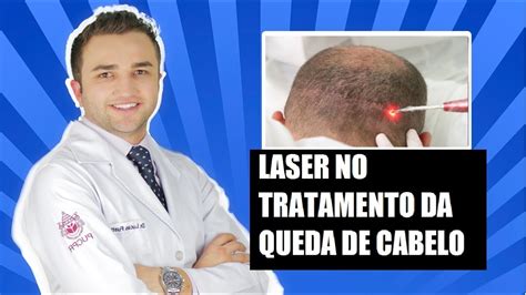 Laser No Tratamento Da Queda De Cabelo Dr Lucas Fustinoni Youtube