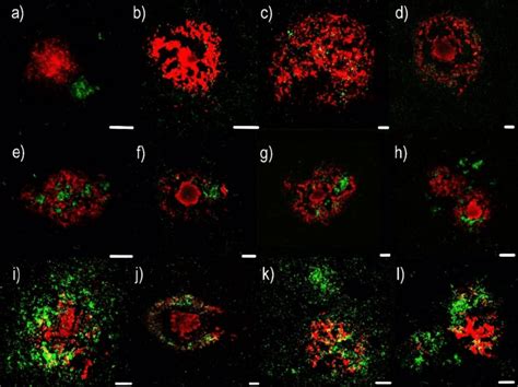 Immunofluorescence Visualization Of Different Types Of Anti Amyloid