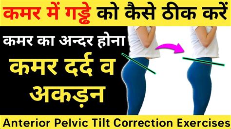 How To Fix Anterior Pelvic Tilt Anterior Pelvic Tilt Anterior