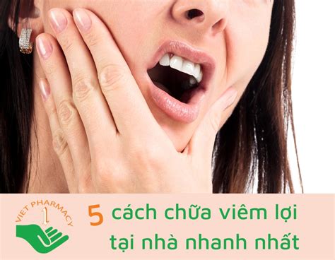 Mách bạn 5 cách chữa viêm lợi tại nhà nhanh nhất