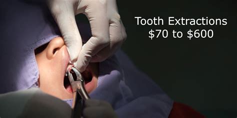 Dental Implant Cost Cost Breakdown Of Dental Implants In Canada