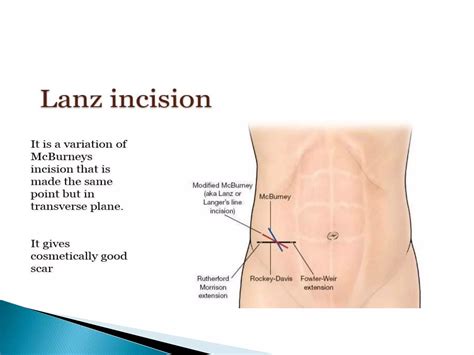 Abdominal Incisions Ppt