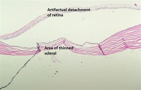 Sclera Histology