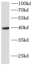 TREM2 Antibody FineTest ELISA Kit FineTest Antibody FineTest