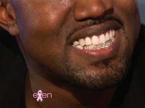 Kanye West Shows Ellen His Diamond Grill Media Crumbs