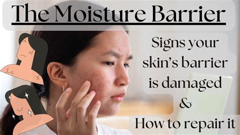 Is Your Skin Barrier Damaged Moisture Barrier Care And Repair Strengthen And Heal Your