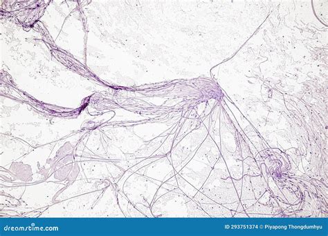 Motor Neuron, Spinal Cord, Nerve Fibres and Nerve Cells Under the ...