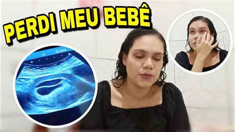 Gravidez De G Meos Perdi Um Beb Saco Gestacional Vazio Youtube