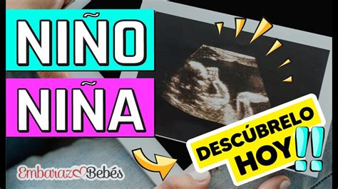 Cómo saber si es NIÑO o NIÑA por Ultrasonido SEMANA 12 a 20 Detecta