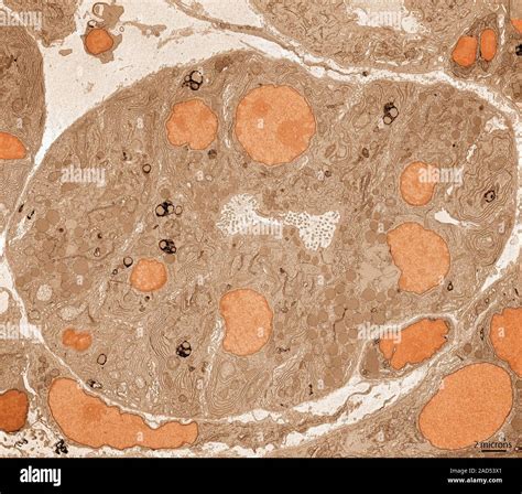 Las células acinares pancreáticas Color micrografía de electrones de