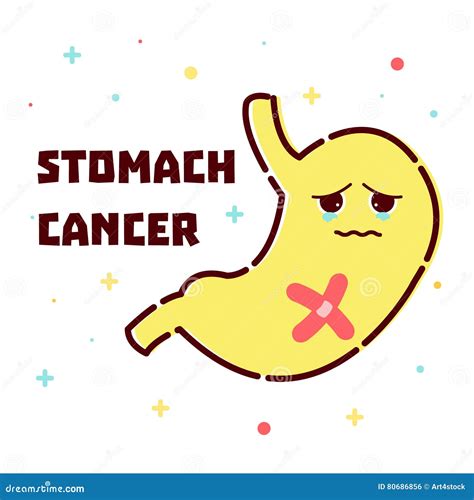 Stomach cancer poster stock illustration. Illustration of body - 80686856