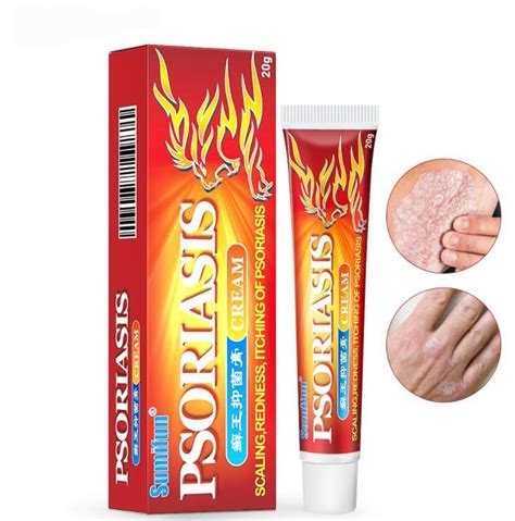 Natuural Herbal Psoriasis Eczema Cream For Dermatitis Pruritus