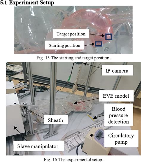 Figure 1 From Development Of A Master Slave Robotic System For Vascular Interventional Surgery