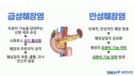 췌장염 치료 수술 전이라면 만성 잔나비