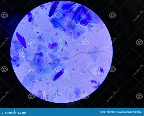 Malassezia Yeast Cytology Of Human Epidermis Royalty Free Stock