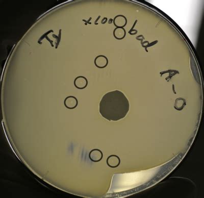 Team:Tokyo Tech/Experiment/Inducible Plaque Forming Assay - 2013.igem.org