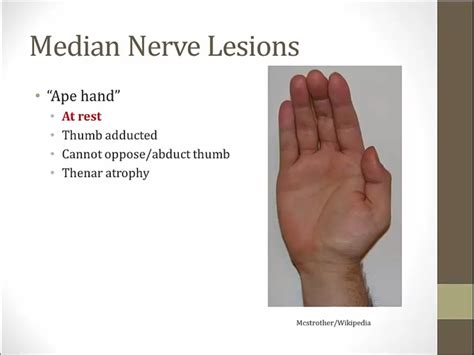 05 Hand • Kang Rui Xiangs Notes