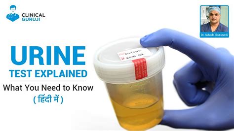 Urine Test Explained What You Need To Know YouTube