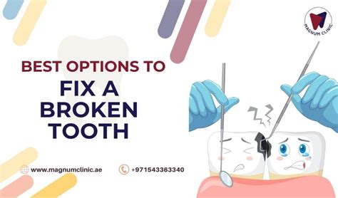 How To Fix Broken Tooth 7 Options To Fix Chipped Tooth