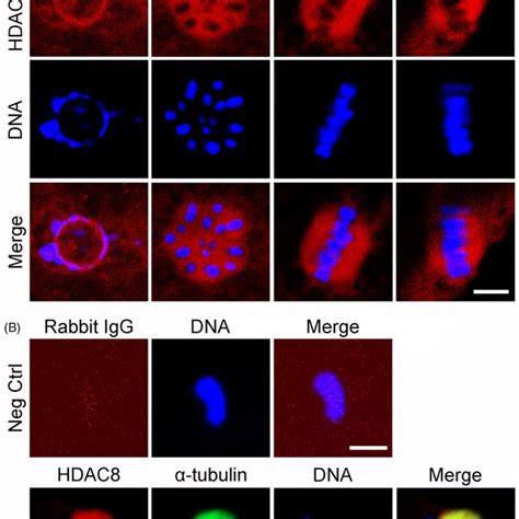 Subcellular Localization And Protein Expression Patterns Of Hdac