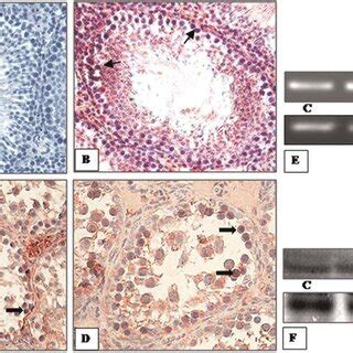 Immunolocalization Of Androgen Receptor Ar In Representative Testis