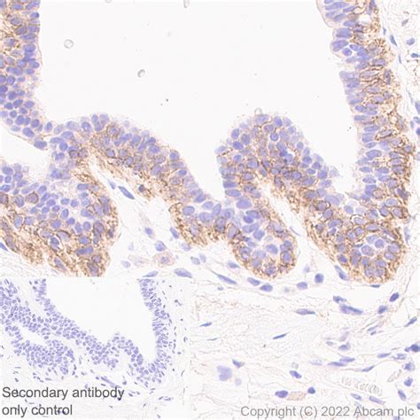 Anti P cadherin 抗体 56 P Cadherin BSA and Azide free ab307741