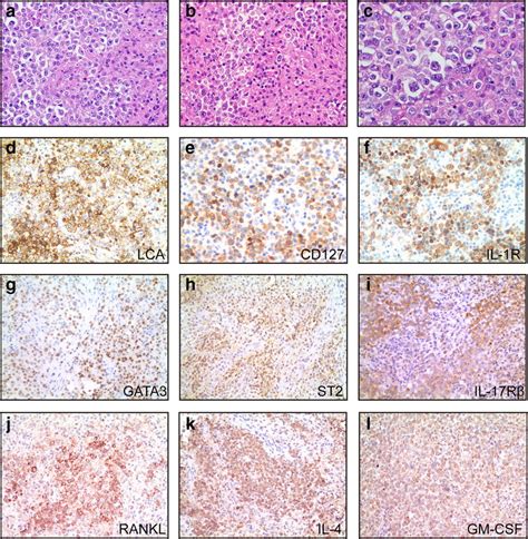 Representative Hematoxylin And Eosin H E And Immunostaining Of Lymph