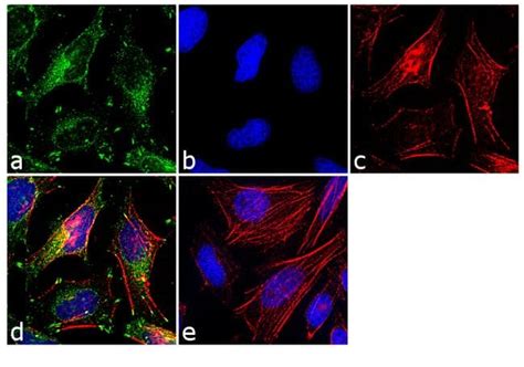 Paxillin Antibody Ma5 13356