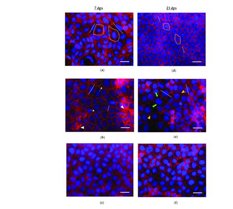 Phalloidin Tritc Dapi Staining Merged Images Of And Dps Caco