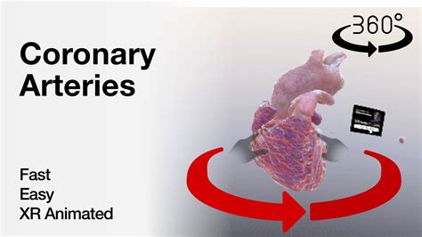 Coronary Arteries - XR Anatomy