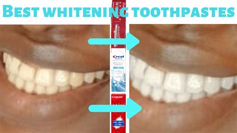 Best Toothpaste For Whitening A Dentists Guide Tried And Trusted