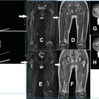 Representative Imaging Results From Case In Table A And B Ct