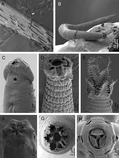 Nematode Electron Microscope