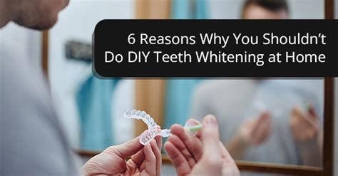 6 Reasons Why You Shouldnt Do Diy Teeth Whitening At Home Oakville