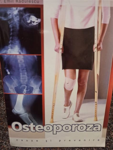 Emil Radulescu Osteoporoza Cauze Si Prevenire Arhiva Okazii Ro