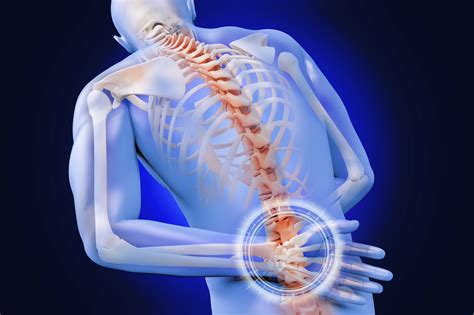 Lumbar Fusion: What You Need To Know About This Back Surgery