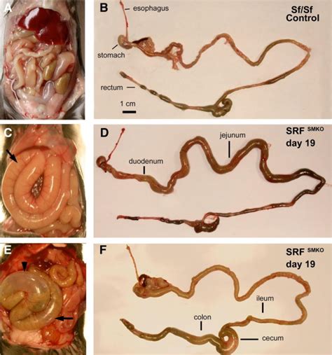 Inducible Mouse Model Of Chronic Intestinal Pseudo Obstruction By